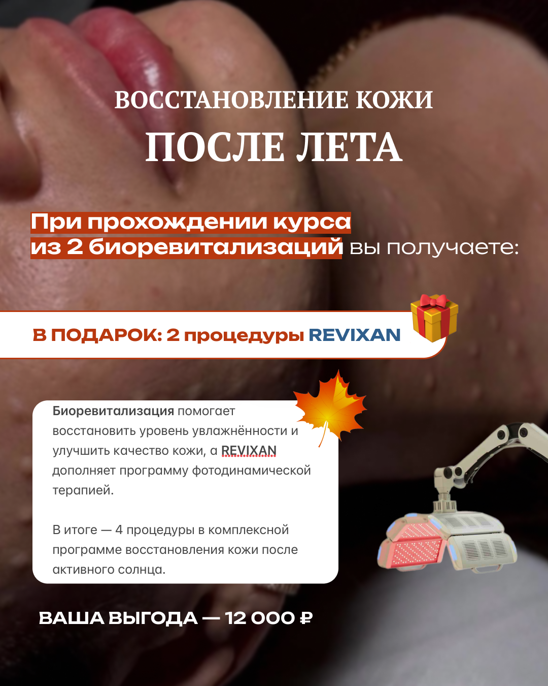 09-3